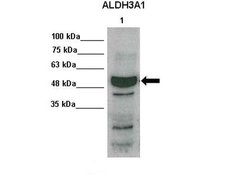 ALDH3A1 Polyclonal Antibody:Antibodies, Polyclonal