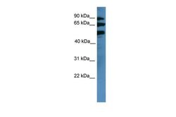 Invitrogen BBS2 Polyclonal Antibody 100 &mu;L; Unconjugated:Antibodies,