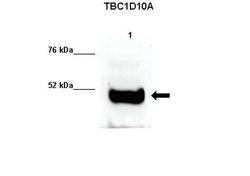 Invitrogen TBC1D10A Polyclonal Antibody 100 &mu;L; Unconjugated:Antibodies,