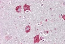Invitrogen HEXA Polyclonal Antibody 100 &mu;L; Unconjugated:Antibodies,