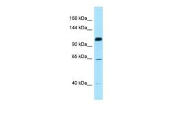Invitrogen SMC6 Polyclonal Antibody 100 &mu;L | Buy Online | Invitrogen&trade; | Fisher Scientific