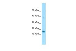 Invitrogen GPIHBP1 Polyclonal Antibody 100 &mu;L; Unconjugated:Antibodies,