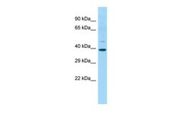 Invitrogen IDO2 Polyclonal Antibody 100 &mu;L | Buy Online | Invitrogen&trade; | Fisher Scientific