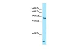 Invitrogen THADA Polyclonal Antibody 100 &mu;L; Unconjugated:Antibodies,