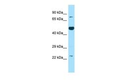 Invitrogen Thromboxane synthase Polyclonal Antibody 100 &mu;L; Unconjugated:Antibodies,