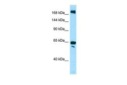 Invitrogen WNK2 Polyclonal Antibody 100 &mu;L; Unconjugated:Antibodies,