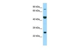 Invitrogen PADI6 Polyclonal Antibody 100 &mu;L | Buy Online | Invitrogen&trade; | Fisher Scientific