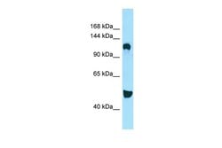 Invitrogen DGKD Polyclonal Antibody 100 &mu;L; Unconjugated:Antibodies,