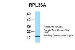 Invitrogen RPL36AL Polyclonal Antibody 100 &mu;L; Unconjugated:Antibodies,