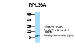 Invitrogen RPL36AL Polyclonal Antibody 100 &mu;L; Unconjugated:Antibodies,
