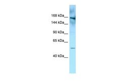 Invitrogen FYCO1 Polyclonal Antibody 100 &mu;L; Unconjugated:Antibodies,