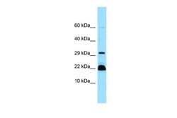 Invitrogen MYLPF Polyclonal Antibody 100 &mu;L; Unconjugated:Antibodies,