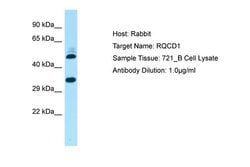 Invitrogen RQCD1 Polyclonal Antibody 100 &mu;L; Unconjugated:Antibodies,