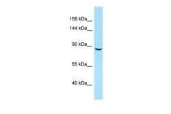 Invitrogen ITIH5 Polyclonal Antibody 100 &mu;L; Unconjugated:Antibodies,