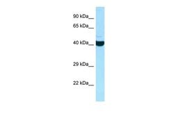 Invitrogen ADPRHL2 Polyclonal Antibody 100 &mu;L; Unconjugated:Antibodies,