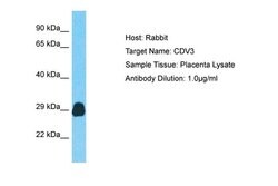 Invitrogen CDV3 Polyclonal Antibody 100 &mu;L | Buy Online | Invitrogen&trade; | Fisher Scientific
