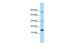 Invitrogen NDUFB4 Polyclonal Antibody 100 &mu;L; Unconjugated:Antibodies,