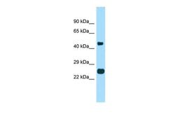 Invitrogen TMBIM4 Polyclonal Antibody 100 &mu;L; Unconjugated:Antibodies,