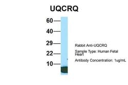 Invitrogen UQCRQ Polyclonal Antibody 100 &mu;L | Buy Online | Invitrogen&trade; | Fisher Scientific