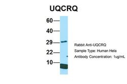 Invitrogen UQCRQ Polyclonal Antibody 100 &mu;L | Buy Online | Invitrogen&trade; | Fisher Scientific