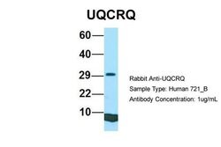 Invitrogen UQCRQ Polyclonal Antibody 100 &mu;L | Buy Online | Invitrogen&trade; | Fisher Scientific