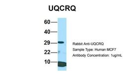 Invitrogen UQCRQ Polyclonal Antibody 100 &mu;L | Buy Online | Invitrogen&trade; | Fisher Scientific