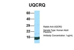 Invitrogen UQCRQ Polyclonal Antibody 100 &mu;L | Buy Online | Invitrogen&trade; | Fisher Scientific