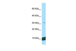 Invitrogen UQCRQ Polyclonal Antibody 100 &mu;L | Buy Online | Invitrogen&trade; | Fisher Scientific