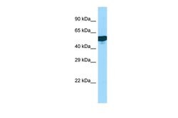 Invitrogen C1rLP Polyclonal Antibody 100 &mu;L; Unconjugated:Antibodies,
