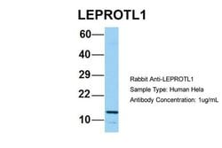 Invitrogen LEPROTL1 Polyclonal Antibody 100 &mu;L; Unconjugated:Antibodies,