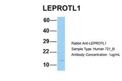 Invitrogen LEPROTL1 Polyclonal Antibody 100 &mu;L; Unconjugated:Antibodies,