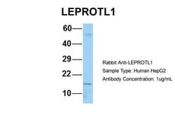 Invitrogen LEPROTL1 Polyclonal Antibody 100 &mu;L; Unconjugated:Antibodies,