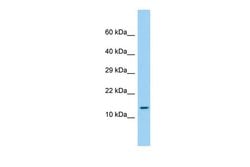 Invitrogen LEPROTL1 Polyclonal Antibody 100 &mu;L; Unconjugated:Antibodies,