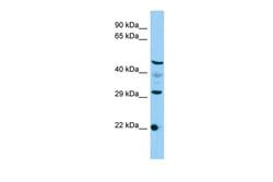 Invitrogen C3orf26 Polyclonal Antibody 100 &mu;L; Unconjugated:Antibodies,