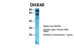 Invitrogen DHX40 Polyclonal Antibody 100 &mu;L; Unconjugated:Antibodies,