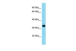 C15orf23 Polyclonal Antibody, Invitrogen 100 &mu;L; Unconjugated:Antibodies,