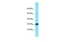 Invitrogen C15orf32 Polyclonal Antibody 100 &mu;L; Unconjugated:Antibodies,