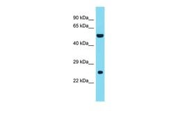 Invitrogen DNAAF3 Polyclonal Antibody 100 &mu;L; Unconjugated:Antibodies,