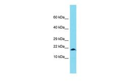 Invitrogen XAGE1 Polyclonal Antibody 100 &mu;L; Unconjugated:Antibodies,