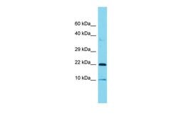 Invitrogen COPZ1 Polyclonal Antibody 100 μL; Unconjugated:Antibodies,