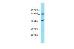 Invitrogen FAM83A Polyclonal Antibody 100 &mu;L | Buy Online | Invitrogen&trade; | Fisher Scientific