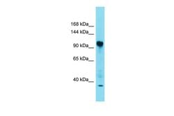 Invitrogen FAM91A1 Polyclonal Antibody 100 &mu;L; Unconjugated:Antibodies,