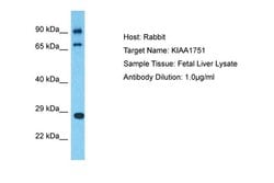 Invitrogen KIAA1751 Polyclonal Antibody 100 &mu;L; Unconjugated:Antibodies,