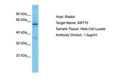 Invitrogen KRT76 Polyclonal Antibody 100 &mu;L; Unconjugated:Antibodies,