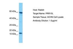 Invitrogen PRR15L Polyclonal Antibody 100 &mu;L; Unconjugated:Antibodies,