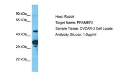 Invitrogen PRAMEF2 Polyclonal Antibody 100 &mu;L; Unconjugated:Antibodies,