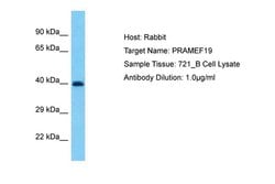 Invitrogen PRAMEF19 Polyclonal Antibody 100 &mu;L; Unconjugated:Antibodies,