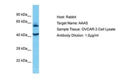 Invitrogen Aladin Polyclonal Antibody 100 &mu;L; Unconjugated:Antibodies,