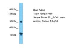Invitrogen SP100 Polyclonal Antibody 100 &mu;L; Unconjugated:Antibodies,