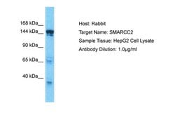 Invitrogen SMARCC2 Polyclonal Antibody 100 &mu;L; Unconjugated:Antibodies,